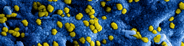 Afbeelding coronavirus, bron: RIVM Afbeelding coronavirus, bron: RIVM